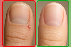 تشخیص دادن مشکلات جدی سلامتی از روی ناخن