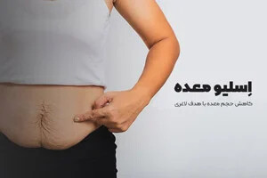 رکورد شکنی اسلیو معده (محبوب‌ ترین جراحی چاقی در سال ۱۴۰۴)