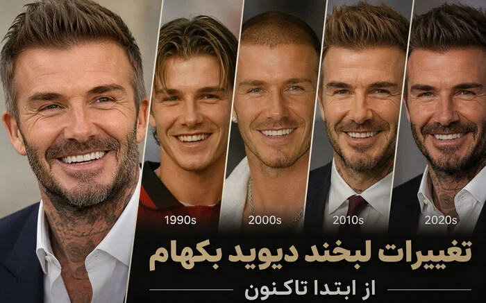 تغییرات لبخند دیوید بکهام (David Beckham) از ابتدا تاکنون