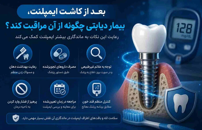 کاشت ایمپلنت برای دیابتی ها
