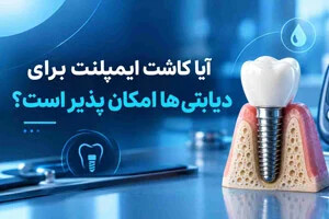 آیا کاشت ایمپلنت برای دیابتی ها امکان پذیر است؟