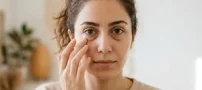 آیا می دانید دلیل و راه درمان پف زیر چشم چیست؟