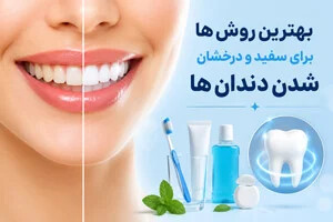 بهترین روش ها برای سفید و درخشان شدن دندان ها