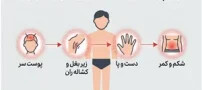 خارش پوست در این قسمت های بدن را جدی بگیرید!