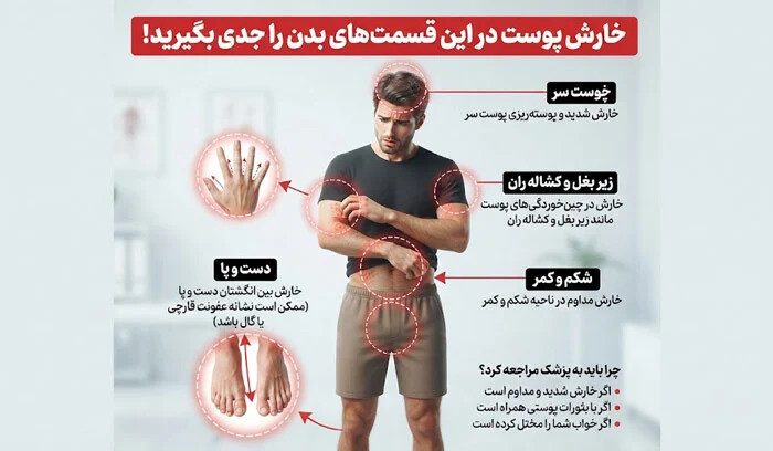 خارش پوست در این قسمت های بدن را جدی بگیرید!