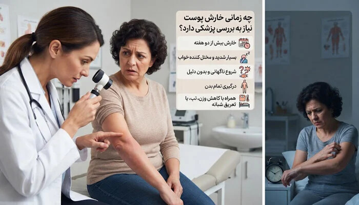 خارش پوست چه زمانی نیاز به بررسی پزشکی دارد؟