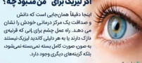 خلاصه‌ای جامع درباره عمل لیزیک: آنچه پیش از تصمیم‌گیری باید بدانید