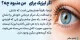 خلاصهای جامع درباره عمل لیزیک: آنچه پیش از تصمیمگیری باید بدانید
