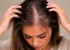 علت های شایع، علائم هشدار و راه های درمان ریزش مو