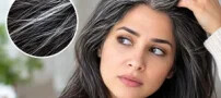 سفیدی زودرس مو؛ علت ها، درمان و راه های مراقبت از موها