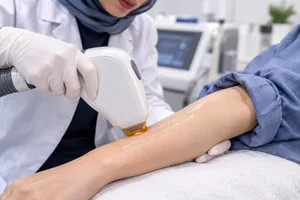 نکات مهم قبل و بعد از لیزر موهای زائد، عوارض و مراقبت های لازم