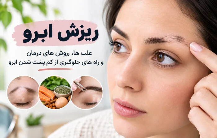 علت ها، روش های درمان و راه های جلوگیری از ریزش ابرو