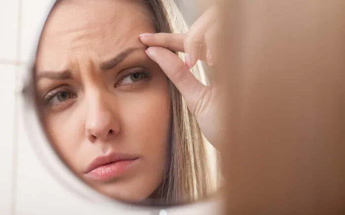 آیا استرس باعث ریزش ابرو می شود؟