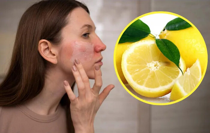 چه موادی را برای روشن کردن پوست استفاده نکنیم؟