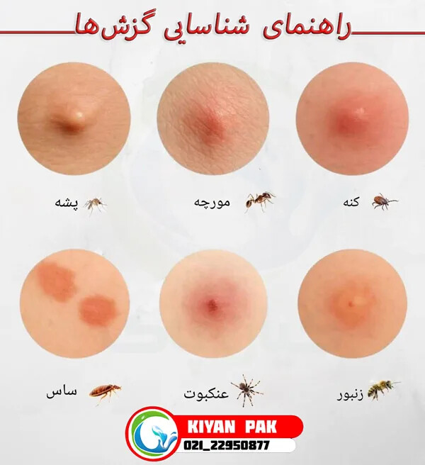ساس یا کنه در خانه؟ ۷نشانه مهم که قبل از سمپاشی باید بشناسید