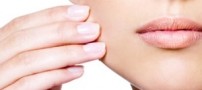 بیماری پسوریازیس ناحیه ای از پوست