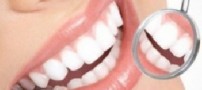 اسراری برای داشتن دندان هایی زیبا