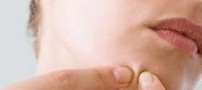با جوشهای بزرگ صورتمان چه کنیم؟