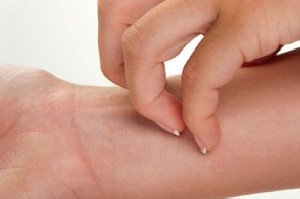 حساسیت پوستی و دیابت