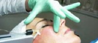 درمان تیرگی دور چشم:Eye Circle