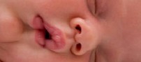 کرمهای دور چشم قبل از خواب