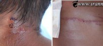 نجات مردی از بین آرواره های قدرتمند كروكودیل (عکس)