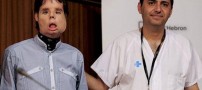 پیوند بسیار عجیب و ترسناک صورت به این مرد! (عکس)
