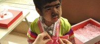 عکس های دختری با رشد بی وقفه مو بر روی صورتش!!