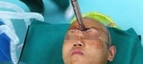 زنده ماندن این مرد بیشتر شبیه معجزه است (عکس)