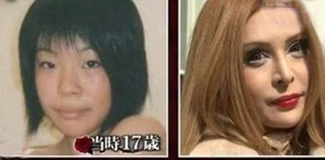 تصویر جالب یک زن چینی قبل از عمل زیبایی و بعد از آن
