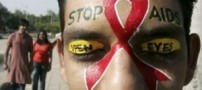 علائم بیماری ایدز HIV