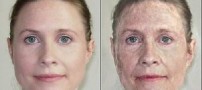 برطرف کردن چین‌وچروک‌های پوست صورت