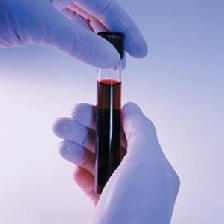ارتباط شخصیت و گروه خونی