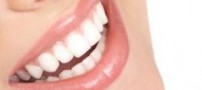 توصیه ای برای داشتن دندان‌هایی سفید و درخشان