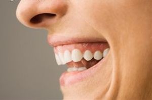 چه نقاطی از دندان مستعد پوسیدگی هستند؟