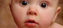 تولد دوقلوهای 3 پا در اصفهان!!