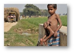 کودک بسیار عجیب هندی با هشت دست و پا