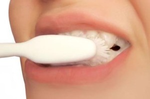 انواع سفیدكننده‌های دندان برای دندان های زرد