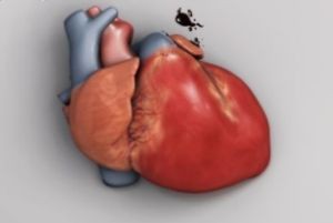 عوامل موثر در ابتلا به بیماری تپش قلب