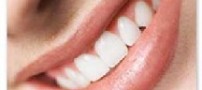 مزایای خنده از دیدگاه های گوناگون !!
