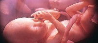 جنایی ترین سرقت جنین توسط دختری 18 ساله