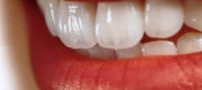 باورهای غلط درباره سلامت دندان ها