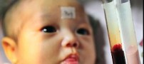 تولد نوزادی که خونش صورتی رنگ است !!
