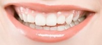 چگونه دندانهای زیبا داشته باشیم ؟