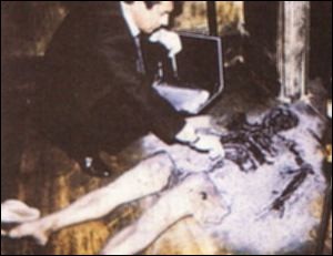 مردی بسیار عجیب که بدنش خود به خود آتش گرفت!