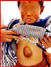 عجیب ترین وضعیت جسمی پسر 5 ساله چینی