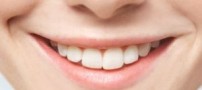 راهکارهایی برای سفیدی خیره کننده دندانها
