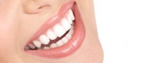 بهترین روش ها برای داشتن دندانهای زیبا و سفید