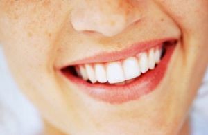 خطرات سفید کردن دندانها
