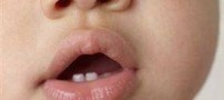 وقتی كودك دندان در می آورد چگونه به او كمك كنیم؟